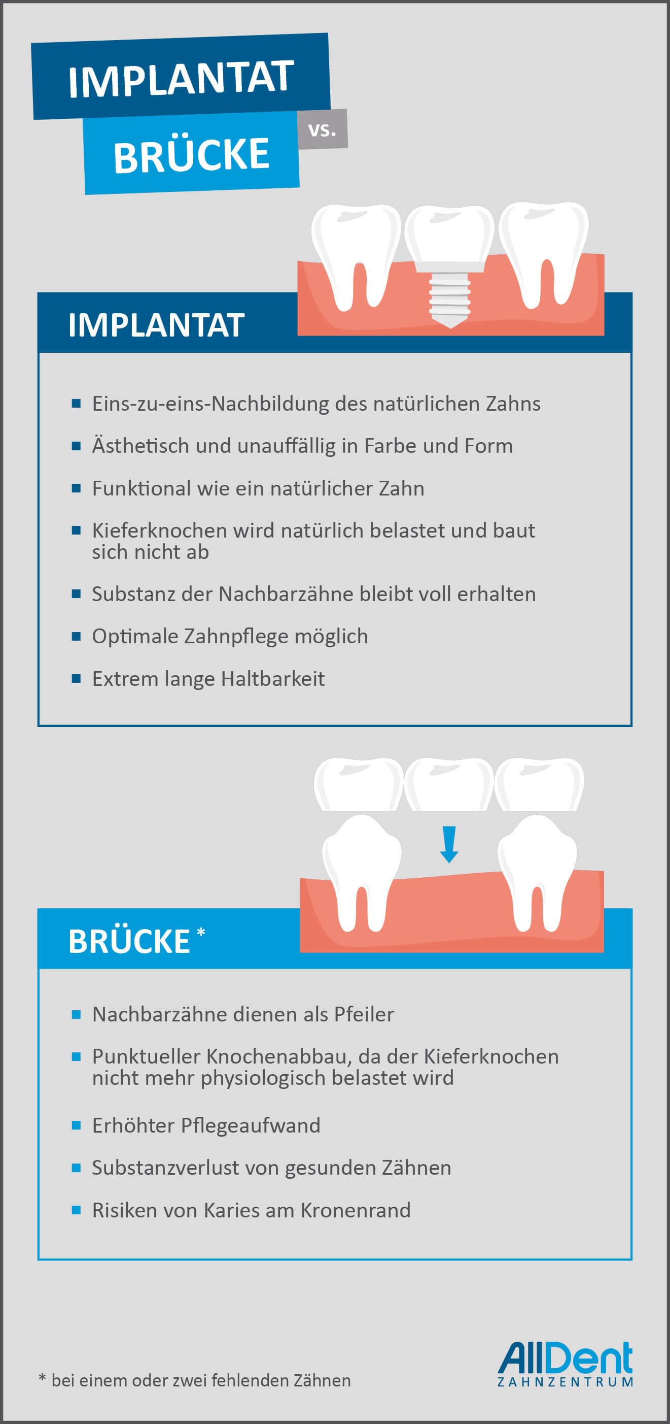 Infografik Zahnimplantat Brücke